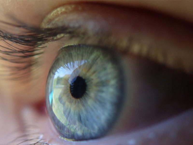 Η αλλαγή στα μάτια που μπορεί να αποτελεί πρώιμο σημάδι μίας σοβαρής νόσου 